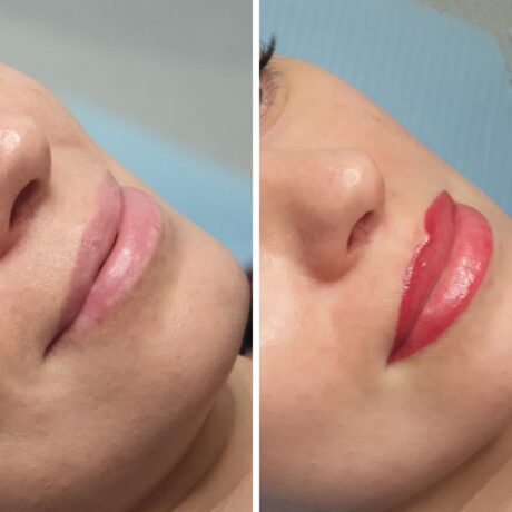 permnent usta permnent usta